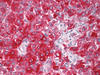 CONFIRM MART-1/melan A - 790-2990 - Ventana Medical Systems, Inc.