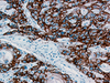 CONFIRM EGFR (Epidermal Growth Factor Receptor) - 790-2988 - Ventana Medical Systems, Inc.