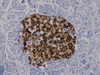 NSE (Neuron Specific Enolase) - 760-2662 - Ventana Medical Systems, Inc.