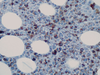 TRAcP (Tartrate-Resistant Acid Phosphatase) - 760-4275 - Ventana Medical Systems, Inc.