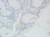 Helicobacter pylori - 790-1014, 790-1015 - Ventana Medical Systems, Inc.