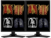 2) 21