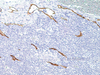Podoplanin - 760-4395 - Ventana Medical Systems, Inc.