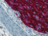 CONFIRM Melanosome - 790-4366 - Ventana Medical Systems, Inc.