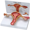 Uterus-Ovary Model - B3480 - Parco Scientific Company