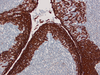 CONFIRM Cytokeratin - 790-2909 - Ventana Medical Systems, Inc.