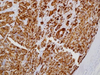 Calcitonin - 760-4705 - Ventana Medical Systems, Inc.