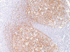 Follicular Dendritic Cell - 760-4255 - Ventana Medical Systems, Inc.