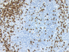 CONFIRM CD3 - 790-4341 - Ventana Medical Systems, Inc.
