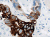 CONFIRM Cytokeratin 20 - 790-4431 - Ventana Medical Systems, Inc.